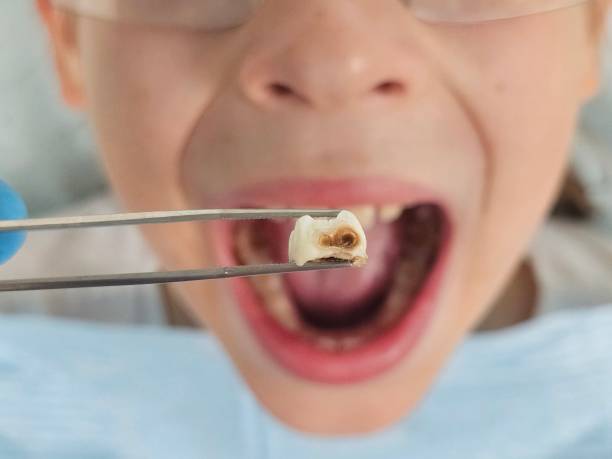 Best Urgent Tooth Repair  in Lakeland, TN