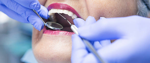 Teeth Whitening in TN